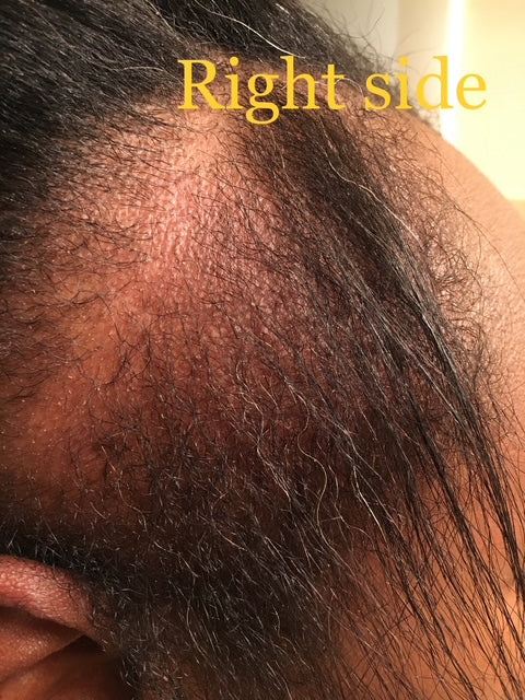 MEGA 32 HAIR GROWTH OIL + AYUEVEDIC RX
