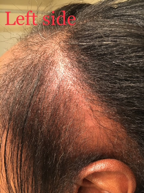 MEGA 32 HAIR GROWTH OIL + AYUEVEDIC RX