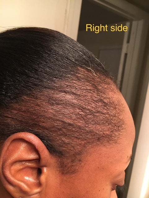 MEGA 32 HAIR GROWTH OIL + AYUEVEDIC RX