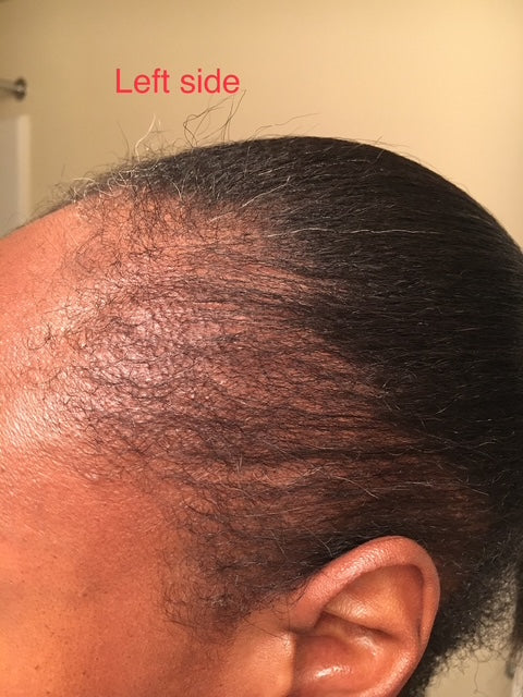 MEGA 32 HAIR GROWTH OIL + AYUEVEDIC RX