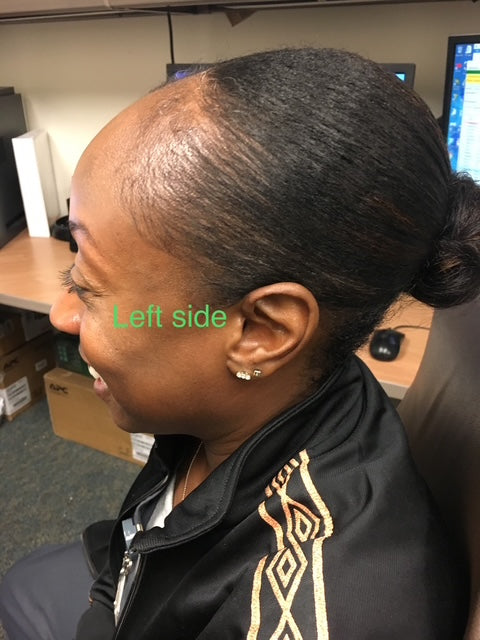 MEGA 32 HAIR GROWTH OIL + AYUEVEDIC RX